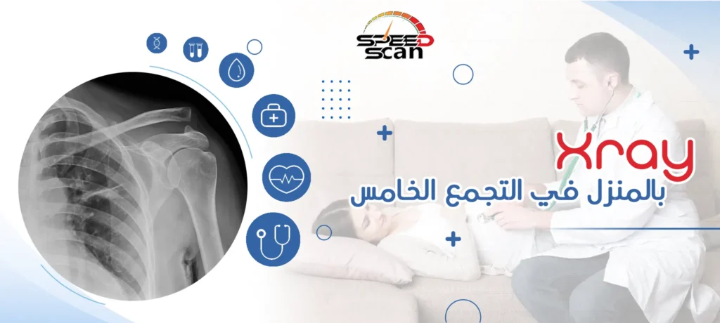 Xray بالمنزل في التجمع الخامس