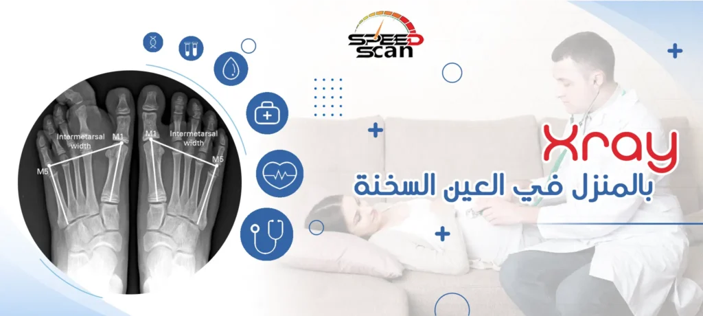 Xray بالمنزل في العين السخنة