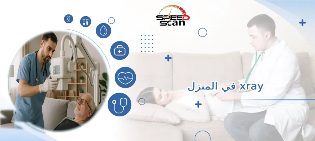 xray في المنزل