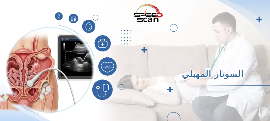 السونار المهبلي
