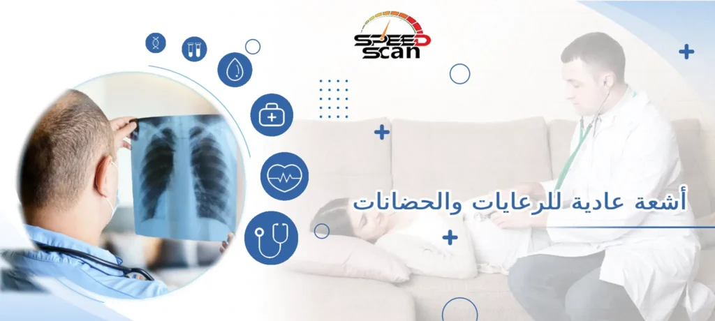 أشعة عادية للرعايات والحضانات